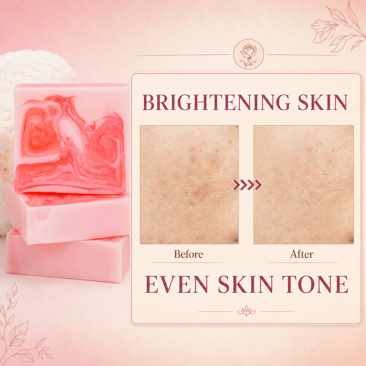 Klyssa Rose & Kojic Acid Soap