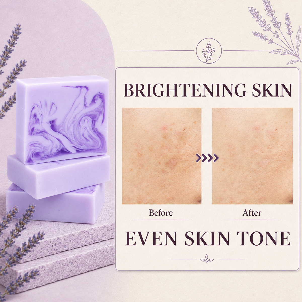 Klyssa Lavender & Kojic Acid Soap